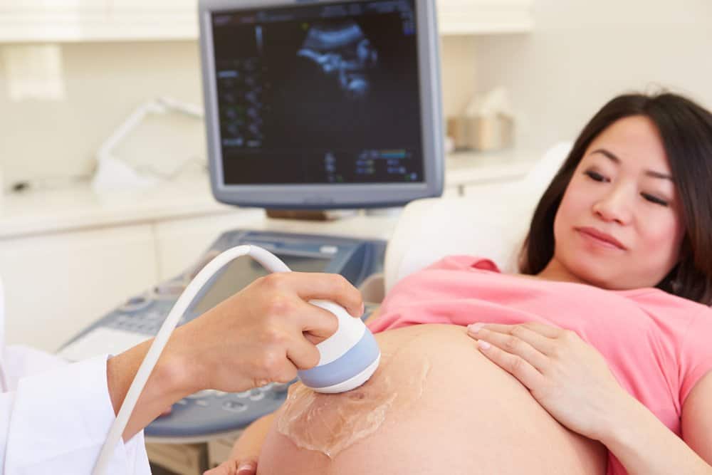 有超聲波掃描的孕婦